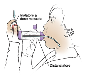 Una donna che usa un inalatore predosato con distanziatore.