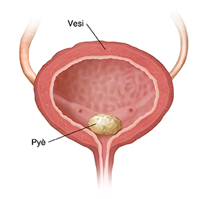 Imaj lateral vesi a kap montre pyè nan vesi a.
