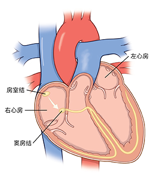 显示心脏的腔室和电通路的心脏侧视图.
