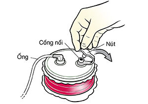 Cận cảnh bàn tay đeo găng đang mở nút ống thoát dịch hemovac.