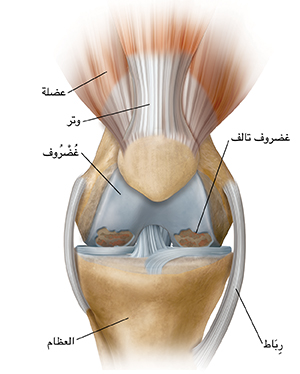 صورة أمامية لركبة تُظهر الفصال العظمي.