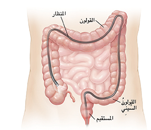 مخطط تفصيلي للبطن يُظهر منظارًا يدخل من خلال فتحة الشرج إلى القولون بأكمله.