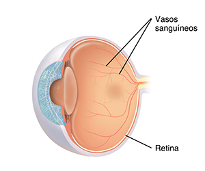 Corte transversal da vista de três quartos do olho, mostrando vasos sanguíneos normais na retina.