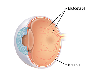 Dreiviertelansicht des Auges mit normalen Blutgefäßen auf der Netzhaut.