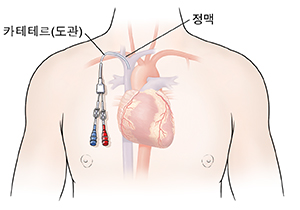 중심선이 있는 심장을 보여주는 남자의 가슴 윤곽선.