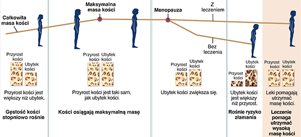 Wykres pokazujący wzrost i utratę kości w ciągu życia kobiety z i bez leczenia osteoporozy.