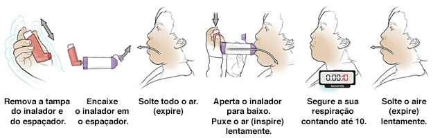 Seis passos no uso de inalador com espaçador.