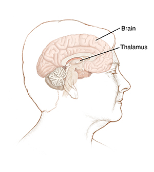 Side view of female head showing cross section of brain.