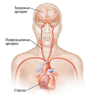 Голова и верхняя часть туловища с изображением сонных артерий и мозга: вид спереди.