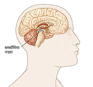 मस्तिष्क की क्रॉस सेक्शन वाली सिर की रूपरेखा। सब्सटैंशिया नाइग्रा मस्तिष्क के निचले केंद्र में छोटा सा क्षेत्र होता है।