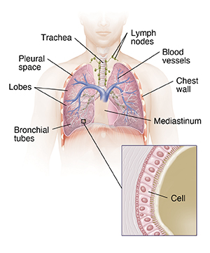 Front view of male chest showing trachea and lungs and inset showing bronchiole cells.