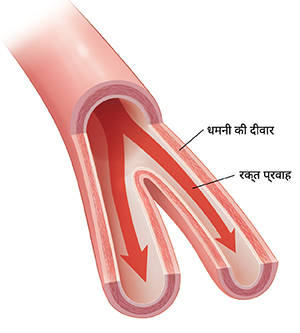 रक्त प्रवाह को दर्शाते हुए धमनी का क्रॉस सेक्शन।