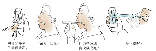 使用峰值流量計的五個步驟。
