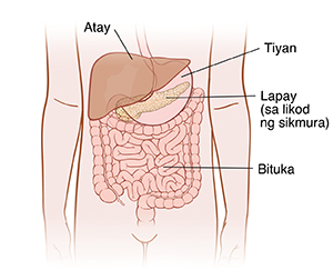 Closeup cross section ng daluyan ng dugo na malapit sa mga selula na ipinapakita ang Type 2 diabetes. Hindi tumutugon ang selula sa insulin. Hindi makapasok ang glucose sa mga selula at natitipon sa daloy ng dugo.