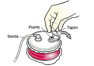 Primer plano de una mano enguantada que abre el tapón de un drenaje Hemovac completo.