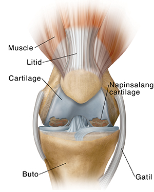 Harapang kuha ng tuhod na ipinakikita ang osteoarthritis.