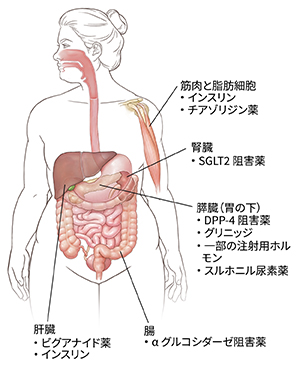 糖尿病治療薬が機能する場所を示す人物像。
