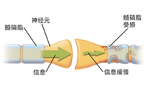 两条神经突触的特写镜头。箭头显示信息顺利通过健康的神经元,但在受损的神经元中断。
