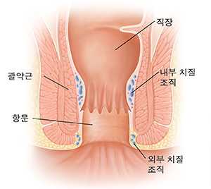 정상적인 직장과 항문의 단면도.