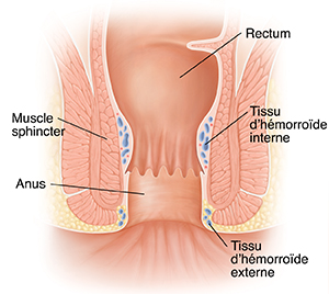 Coupe transversale d'un rectum et d'un anus normaux.
