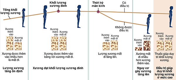 Biểu đồ thể hiện sự phát triển và mất đi của xương theo tuổi thọ của phụ nữ, được và không được điều trị loãng xương.