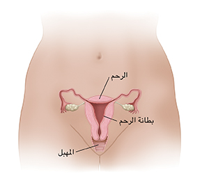 مقطع عرضي لمنظر أمامي للرحم والمهبل يُبيِّن تبطين بطانة الرحم داخل الرحم.