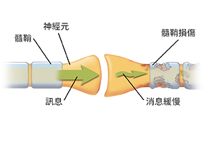 兩個神經元匯合的突觸的特寫。箭頭顯示訊息沿著健康的神經元移動,並在受損的神經元中被中斷。